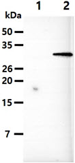 The Cell lysates (10ug) were resolved by SDS-PAGE, transferred to PVDF membrane and probed with anti-human UBE2S antibody (1:1000). Proteins were visualized using a goat anti-mouse secondary antibody conjugated to HRP and an ECL detection system.Lane 1.: 293T cell lysateLane 2.: UBE2S transfected 293T cell lysate