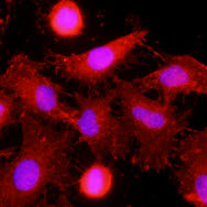Immunofluorescence of human HeLa cells stained with monoclonal anti-human MINCLE antibody (1:500) with Texas Red (Red). Nucleus was stained by Hoechst 33342 (Blue).