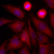 Immunofluorescence of human HeLa cells stained with Hoechst 3342 (Blue) for nucleus staining and monoclonal anti-human GAPDH antibody (1:500) with Texas Red (Red).