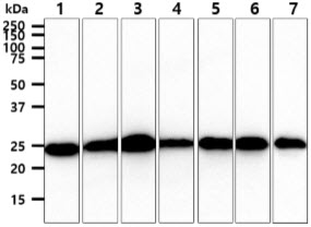 The cell lysate (40ug) were resolved by SDS-PAGE, transferred to PVDF membrane and probed with anti-human BAK1 antibody (1:1000). Proteins were visualized using a goat anti-mouse secondary antibody conjugated to HRP and an ECL detection system.Lane 1 : 293T cell lysateLane 2 : HeLa cell lysateLane 3 : A431 cell lysateLane 4 : A549 cell lysateLane 5 : Jurkat cell lysateLane 6 : MCF7 cell lysateLane 7 : PC3 cell lysate
