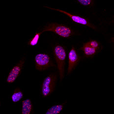 Immunofluorescence of human HeLa cells stained with Hoechst 3342 (Blue) for nucleus staining and monoclonal anti-human SUMO2/3 antibody (1:500) with Texas Red (Red).
