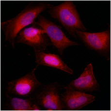Immunofluorescence of HeLa cells stained with Hoechst 3342 (Blue) for nucleus staining and with monoclonal anti-human Bcl-2 antibody (1:500) with Texas Red (Red). 