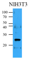 Cell lysates (35ug) were resolved by SDS-PAGE, transferred to PVDF membrane and probed with anti-human Bcl-2 (1:500). Proteins were visualized using a goat anti-mouse secondary antibody conjugated to HRP and an ECL detection system.