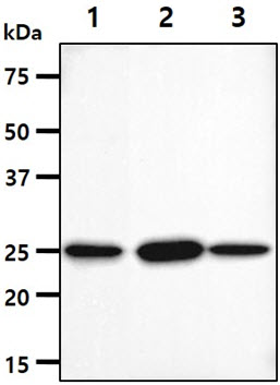 The cell lysates (40ug) were resolved by SDS-PAGE, transferred to PVDF membrane and probed with anti-human NQO2 antibody (1:1000). Proteins were visualized using a goat anti-mouse secondary antibody conjugated to HRP and an ECL detection system.Lane 1.: HeLa cell lysate Lane 2.: K562 cell lysate Lane 3.: A549 cell lysate 