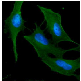 Immunofluorescence of HeLa cells stained with Hoechst 3342 (Blue) for nucleus staining and monoclonal anti-human KRT18 antibody (1:500) with Texas Red (Red).ICC/IF analysis of KRT18 in HeLa cells line, stained with DAPI (Blue) for nucleus staining and monoclonal anti-human KRT18 antibody (1:100) with goat anti-mouse IgG-Alexa fluor 488 conjugate (Green).