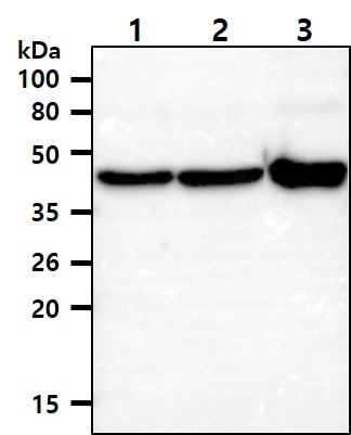 The Cell lysates of HeLa and AGS (35ug) were resolved by SDS-PAGE, transferred to PVDF membrane and probed with anti-human KRT18 (1:1000). Proteins were visualized using a goat anti-mouse secondary antibody conjugated to HRP and an ECL detection system.The Cell lysates (40ug) were resolved by SDS-PAGE, transferred to PVDF membrane and probed with anti-human KRT18 antibody (1:1000). Proteins were visualized using a goat anti-mouse secondary antibody conjugated to HRP and an ECL detection system.Lane 1.: A549 cell lysate