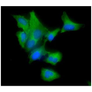 ICC/IF analysis of CAV1 in A549 cells line, stained with DAPI (Blue) for nucleus staining and monoclonal anti-human CAV1 antibody (1:100) with goat anti-mouse IgG-Alexa fluor 488 conjugate (Green).