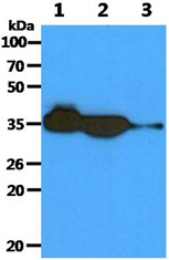 The Recombinant protein (50ng) and Cell lysates (40ug) were resolved by SDS-PAGE, transferred to PVDF membrane and probed with anti-human AKR1C1 antibody (1:1000). Proteins were visualized using a goat anti-mouse secondary antibody conjugated to HRP and an ECL detection system.Lane 1. : Recombinant Human AKR1C1Lane 2. : HepG2 cell lysate Lane 3. : Raji cell lysate