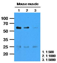 The extracts of Mouse muscle (35ug) were resolved by SDS-PAGE, transferred to PVDF membrane and probed with anti-human CASQ2 (1:1000). Proteins were visualized using a goat anti-mouse secondary antibody conjugated to HRP and an ECL detection system.