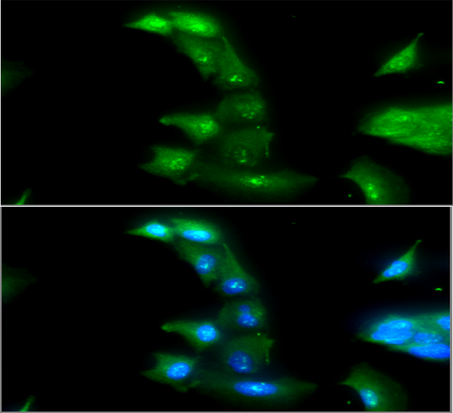 ICC/IF analysis of ADK in A549 cells line, stained with DAPI (Blue) for nucleus staining and monoclonal anti-human ADK antibody (1:100) with goat anti-mouse IgG-Alexa fluor 488 conjugate (Green).