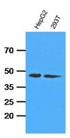 The cell lysates (35ug) were resolved by SDS-PAGE, transferred to PVDF membrane and probed with anti-human ADK (1:1000). Proteins were visualized using a goat anti-mouse secondary antibody conjugated to HRP and an ECL detection system.