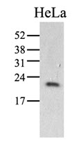 The HeLa (40ug) were resolved by SDS-PAGE, transferred to PVDF membrane and probed with anti-human PPIC antibody (1:1000). Proteins were visualized using a goat anti-mouse secondary antibody conjugated to HRP and an ECL detection system.