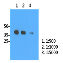 H1N1/HA1 recombinant protein (50ng) were resolved by SDS-PAGE, transferred to PVDF membrane and probed with anti-human H1N1/HA1 antibody (1:500). (1:1000), (1:5000). Proteins were visualized using a goat anti-mouse secondary antibody conjugated to HRP and an ECL detection system. 