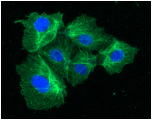 ICC/IF analysis of KRT23 in Hep3B cells line, stained with DAPI (Blue) for nucleus staining and monoclonal anti-human  KRT23 antibody (1:100) with goat anti-mouse IgG-Alexa fluor 488 conjugate (Green).