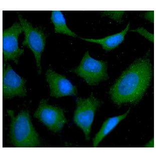 ICC/IF analysis of NAGK in HeLa cells line, stained with DAPI (Blue) for nucleus staining and monoclonal anti-human NAGK antibody (1:100) with goat anti-mouse IgG-Alexa fluor 488 conjugate (Green).