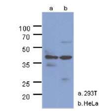 The cell lysates (40ug) were resolved by SDS-PAGE, transferred to PVDF membrane and probed with anti-human NAGK antibody (1:1000). Proteins were visualized using a goat anti-mouse secondary antibody conjugated to HRP and an ECL detection system.