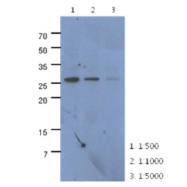 The extracts of HeLa (40ug) were resolved by SDS-PAGE, transferred to PVDF membrane and probed with anti-human CMBL antibody (1:500 ~ 1:5000). Proteins were visualized using a goat anti-mouse secondary antibody conjugated to HRP and an ECL detection system.