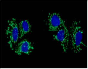 ICC/IF analysis of ACAT1 in Hep3B cells line, stained with DAPI (Blue) for nucleus staining and monoclonal anti-human   ACAT1 antibody (1:100) with goat anti-mouse IgG-Alexa fluor 488 conjugate (Green).