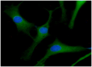 ICC/IF analysis of ACOT7 in U87MG cells line, stained with DAPI (Blue) for nucleus staining and monoclonal anti-human ACOT7 antibody (1:100) with goat anti-mouse IgG-Alexa fluor 488 conjugate (Green).