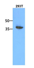 The 293T cell lysate (30ug) were resolved by SDS-PAGE, transferred to PVDF membrane and probed with anti-human ACOT7 antibody (1:1000). Proteins were visualized using a goat anti-mouse secondary antibody conjugated to HRP and an ECL detection system.