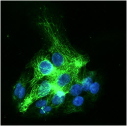 ICC/IF analysis of KRT19 in HepG2 cells line, stained with DAPI (Blue) for nucleus staining and monoclonal anti-human HepG2 antibody (1:100) with goat anti-mouse IgG-Alexa fluor 488 conjugate (Green).