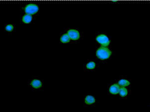 ICC/IF analysis of CTLA4 in Jurkat cells line, stained with DAPI (Blue) for nucleus staining and monoclonal anti-human CTLA4 antibody (1:100) with goat anti-mouse IgG-Alexa fluor 488 conjugate (Green).