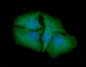 ICC/IF analysis of SMAC in HeLa cells line, stained with DAPI (Blue) for nucleus staining and monoclonal anti-human    SMAC antibody (1:100) with goat anti-mouse IgG-Alexa fluor 488 conjugate (Green).