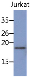 The cell lysate of Jurkat (30ug) were resolved by SDS-PAGE, transferred to PVDF membrane and probed with anti-human NBL1 antibody (1:1000). Proteins were visualized using a goat anti-mouse secondary antibody conjugated to HRP and an ECL detection system.
