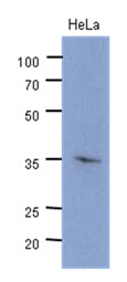 The cell lysate of HeLa (40ug) were resolved by SDS-PAGE, transferred to PVDF membrane and probed with anti-human CDK4 antibody (1:500). Proteins were visualized using a goat anti-mouse secondary antibody conjugated to HRP and an ECL detection system.