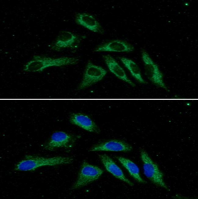 ICC/IF analysis of PPM1F in HeLa cells line, stained with DAPI (Blue) for nucleus staining and monoclonal anti-human    PPM1F antibody (1:100) with goat anti-mouse IgG-Alexa fluor 488 conjugate (Green).