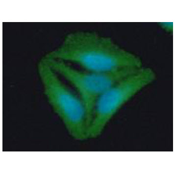 ICC/IF analysis of STOM in HeLa cells line, stained with DAPI (Blue) for nucleus staining and monoclonal anti-human STOM antibody (1:100) with goat anti-mouse IgG-Alexa fluor 488 conjugate (Green).