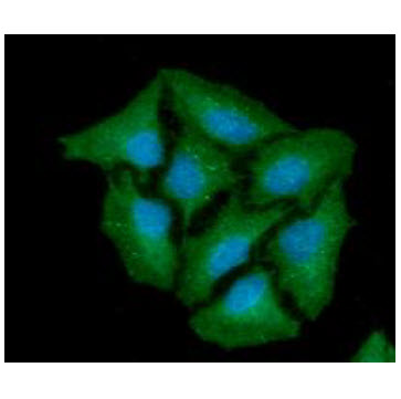 ICC/IF analysis of CTSZ in HeLa cells line, stained with DAPI (Blue) for nucleus staining and monoclonal anti-human   CTSZ antibody (1:100) with goat anti-mouse IgG-Alexa fluor 488 conjugate (Green).