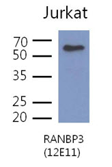 The cell lysates of Jurkat (40ug) were resolved by SDS-PAGE, transferred to PVDF membrane and probed with anti-human RANBP3 antibody (1:500). Proteins were visualized using a goat anti-mouse secondary antibody conjugated to HRP and an ECL detection system.