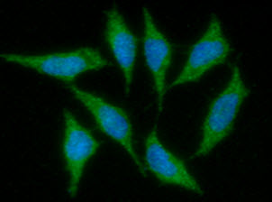 ICC/IF analysis of IGF1 in PC3 cells. The cell was stained with ATGA0311 (1:100). The secondary antibody (green) was used Alexa Fluor 488. DAPI was stained the cell nucleus (blue).