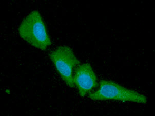 ICC/IF analysis of 14-3-3 gamma in HeLa cells line, stained with DAPI (Blue) for nucleus staining and monoclonal anti-human 14-3-3 gamma antibody (1:100) with goat anti-mouse IgG-Alexa fluor 488 conjugate (Green).