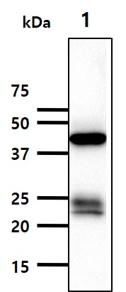 The lysate of Mouse kidney(40ug) were resolved by SDS-PAGE, transferred to PVDF membrane and probed with anti-human LRPAP1 antibody (1:500). Proteins were visualized using a goat anti-mouse secondary antibody conjugated to HRP and an ECL detection system.