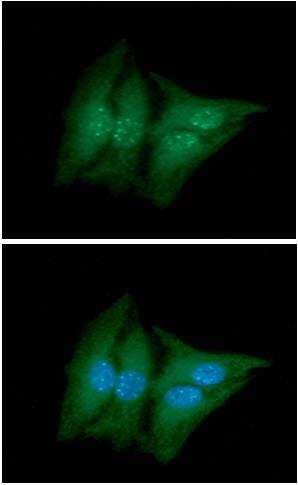 ICC/IF analysis of ACY1 in HeLa cells line, stained with DAPI (Blue) for nucleus staining and monoclonal anti-human   ACY1 antibody (1:100) with goat anti-mouse IgG-Alexa fluor 488 conjugate (Green).