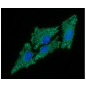 ICC/IF analysis of C1QBP in HeLa cells line, stained with DAPI (Blue) for nucleus staining and monoclonal anti-human    C1QBP antibody (1:100) with goat anti-mouse IgG-Alexa fluor 488 conjugate (Green).