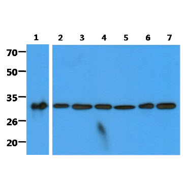 The recombinant protein(50ng) and cell lysates(40ug) were resolved by SDS-PAGE, transferred to PVDF membrane and probed with anti-human C1QBP antibody (1:2000). Proteins were visualized using a goat anti-mouse secondary antibody conjugated to HRP and an ECL detection system.Lane 1 : Recombinant protein Lane 2 : HeLa cell lysate Lane 3 : Jurkat cell lysate Lane 4 : MCF7 cell lysate Lane 5 : Ramos cell lysate Lane 6 : 293T cell lysateLane 7 : A549 cell lysate