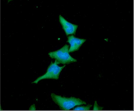 ICC/IF analysis of ACAT2 in HeLa cells line, stained with DAPI (Blue) for nucleus staining and monoclonal anti-human   ACAT2 antibody (1:100) with goat anti-mouse IgG-Alexa fluor 488 conjugate (Green).