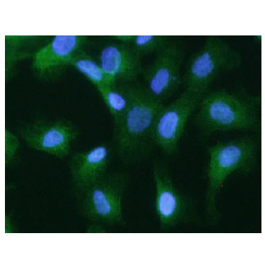ICC/IF analysis of KRT20 in A549 cells, stained with DAPI (Blue) for nucleus staining and monoclonal anti-human KRT20 antibody (1:200) with goat anti-mouse IgG-Alexa fluor 488 conjugate (Green).