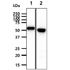 The Recombinant Human KRT20 (25ng) and Cell lysates of HeLa, A431(40ug) were resolved by SDS-PAGE, transferred to PVDF membrane and probed with anti-human KRT20 antibody (1:3000). Proteins were visualized using a goat anti-mouse secondary antibody conjugated to HRP and an ECL detection system.Lane 1.: Recombinant Human KRT20Lane 2.: HeLa cell lysateLane 3.: A431 cell lysate