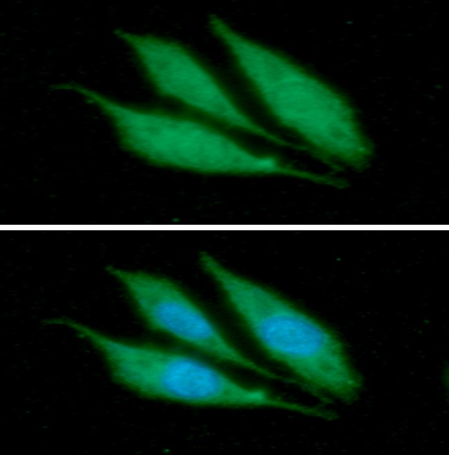 ICC/IF analysis of KRT14 in PC3 cells line, stained with DAPI (Blue) for nucleus staining and monoclonal anti-human   KRT14 antibody (1:100) with goat anti-mouse IgG-Alexa fluor 488 conjugate (Green).