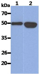 The Recombinant Human KRT14 (50ng) and Cell lysates (40ug) were resolved by SDS-PAGE, transferred to PVDF membrane and probed with anti-human KRT14 antibody (1:1000). Proteins were visualized using a goat anti-mouse secondary antibody conjugated to HRP and an ECL detection system.Lane 1.: Recombinant Human KRT14Lane 2.: A431 cell lysate