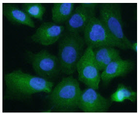 ICC/IF analysis of ALDOA in A549 cells, stained with DAPI (Blue) for nucleus staining and monoclonal anti-human A549 antibody (1:200) with goat anti-mouse IgG-Alexa fluor 488 conjugate (Green).