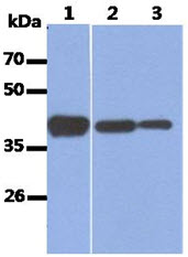 The Recombinant Human ALDOA and Cell lysates (40ug) were resolved by SDS-PAGE, transferred to PVDF membrane and probed with anti-human ALDOA antibody (1:1000). Proteins were visualized using a goat anti-mouse secondary antibody conjugated to HRP and an ECL detection system.Lane 1.: Recombinant Human ALDOALane 2.: HeLa cell lysateLane 3.: HepG2 cell lysate