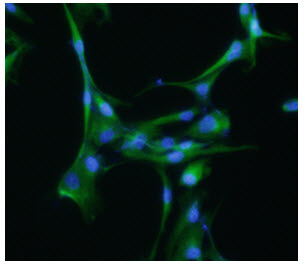 ICC/IF analysis of Tubulin Beta 3 in U-87MG cells, stained with DAPI (Blue) for nucleus staining and monoclonal anti-human Tubulin Beta 3 antibody (1:200) with goat anti-mouse IgG-Alexa fluor 488 conjugate (Green).