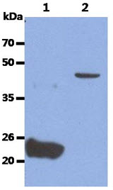 The Recombinant Human GPC4 (50ng) and Cell lysate (40ug) were resolved by SDS-PAGE, transferred to PVDF membrane and probed with anti-human GPC4 anibody (1:1000). Proteins were visualized using a goat anti-mouse secondary antibody conjugated to HRP and an ECL detection system.Lane 1. : Recombinant Human GPC4Lane 2. : Ramos cell lysate