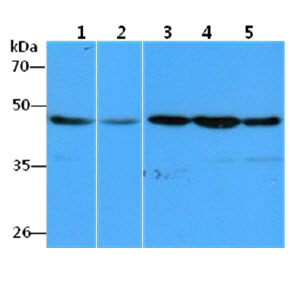The Cell lysates (40ug) were resolved by SDS-PAGE, transferred to PVDF membrane and probed with anti-human EEF1A1 antibody (1:1000). Proteins were visualized using a goat anti-mouse secondary antibody conjugated to HRP and an ECL detection system.Lane 1.: HeLa cell lysateLane 2.: A549 cell lysateLane 3.: Raji cell lysateLane 4.: THP-1 cell lysateLane 5.: MCF-7 cell lysate
