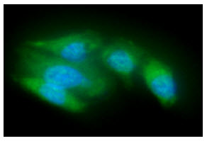 ICC/IF analysis of ACOT8 in A549 cells line, stained with DAPI (Blue) for nucleus staining and monoclonal anti-human ACOT8 antibody (1:100) with goat anti-mouse IgG-Alexa fluor 488 conjugate (Green).